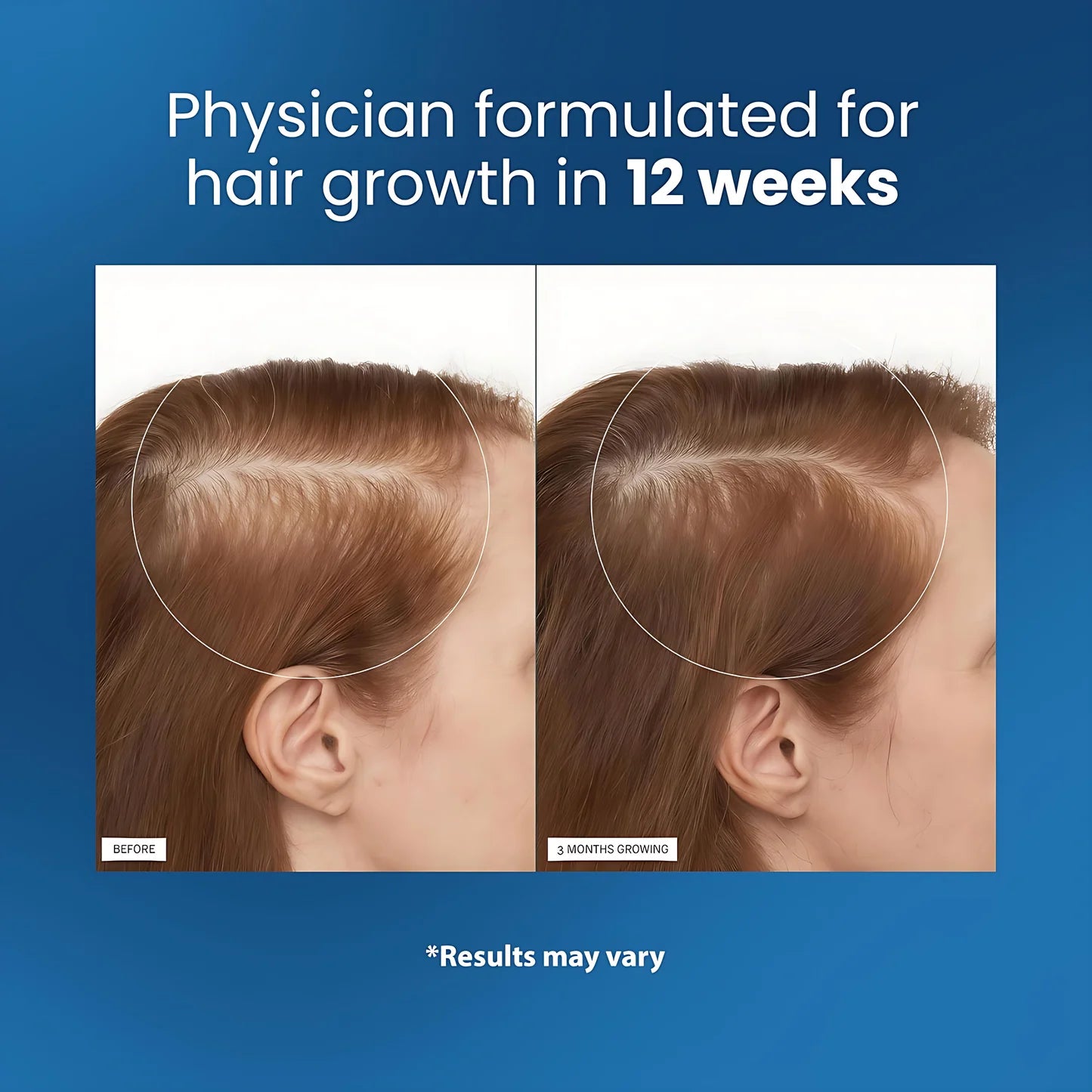 Nourish & Revive Hair Oil™