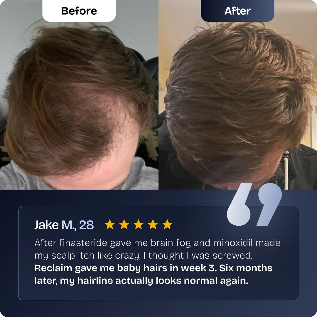 Nourish & Revive Hair Oil™