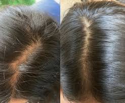 Nourish & Revive Hair Oil™